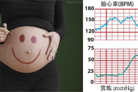 胎心率看男女准不准（胎心率看男女准不准以几个月为准）-第2张图片