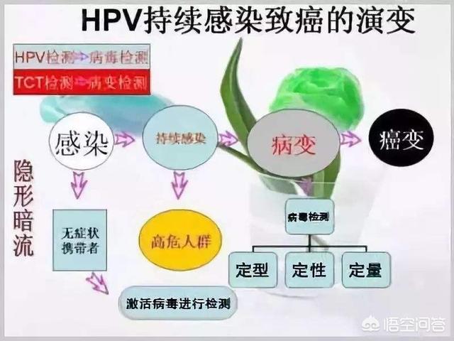 hpv病毒怎么产生的（第一例hpv病毒怎么产生的）-第1张图片