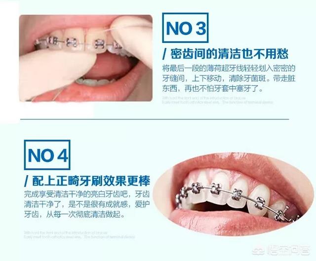 牙线哪个品牌好用（牙线什么牌子的好）-第6张图片